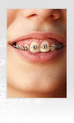 Dental Progress - clinica stomatologica